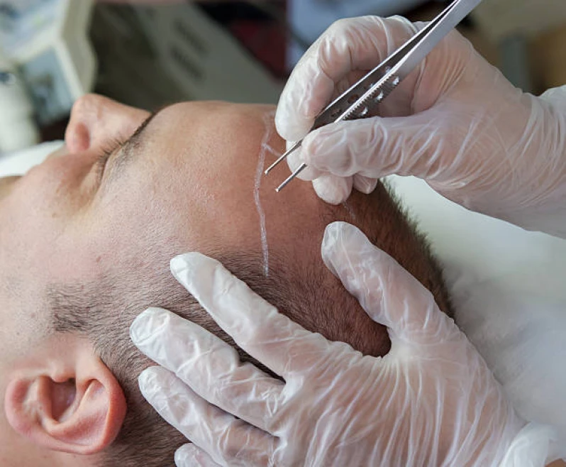 clínica de tratamento de cabelo