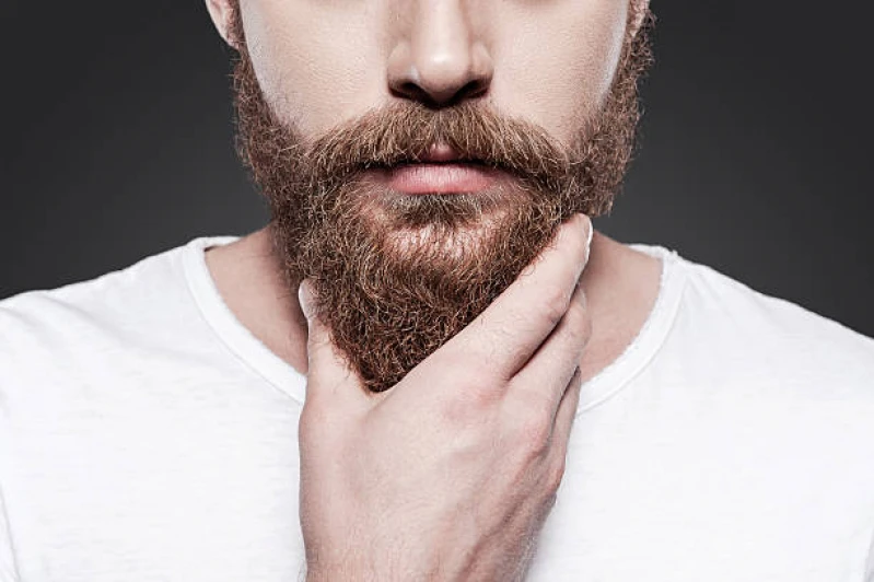 implante capilar na barba