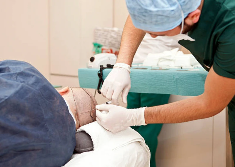 implante capilar para homens