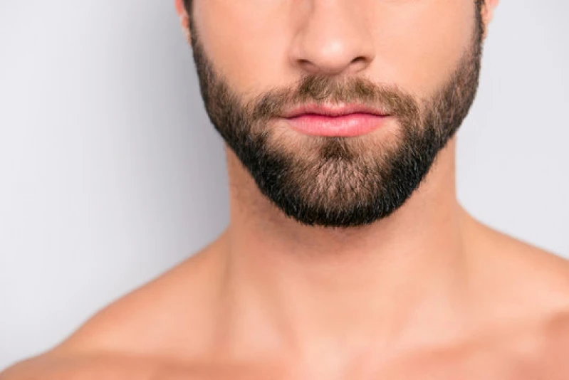 implante na barba