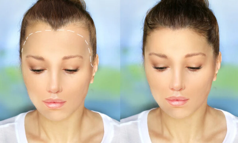 procedimento para crescer cabelo