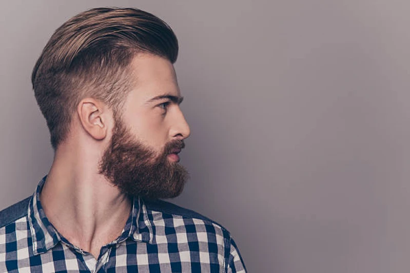 transplante capilar barba