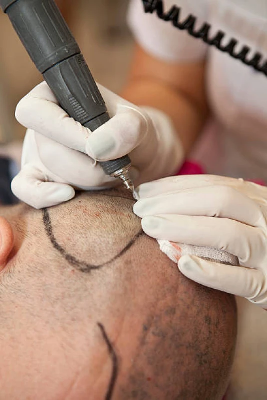 tratamento para cabelo