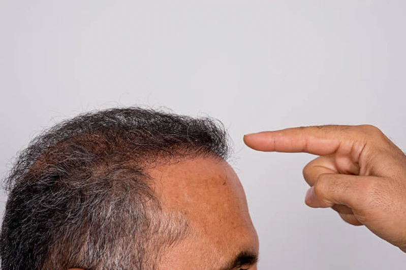 tratamento para queda de cabelo feminino