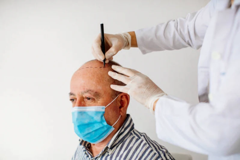 tratamento para queda de cabelo masculino