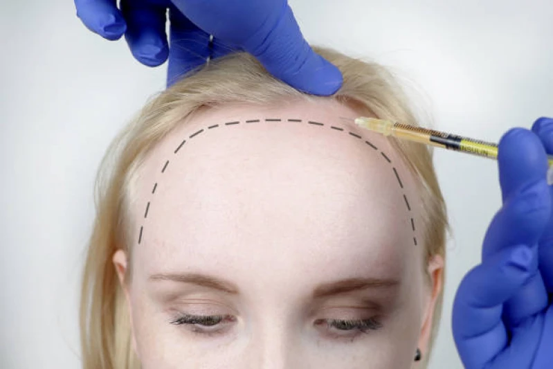 tratamentos para cabelo